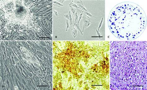 Microscopia di cellule differenziate in linee osteogenica, adipogenica e condrogenica