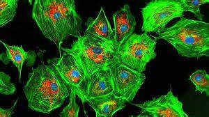 Cellule DT-MSC modificate geneticamente con espressione di GFP