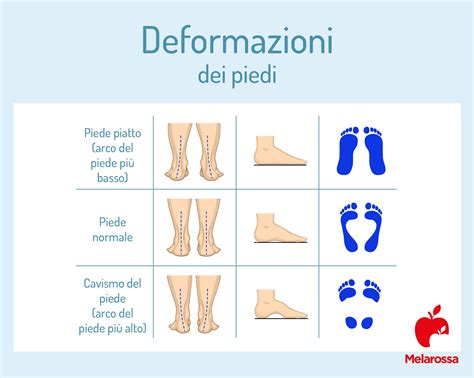 Schema comparativo delle larghezze sotto il piede di diversi tipi di sci alpini