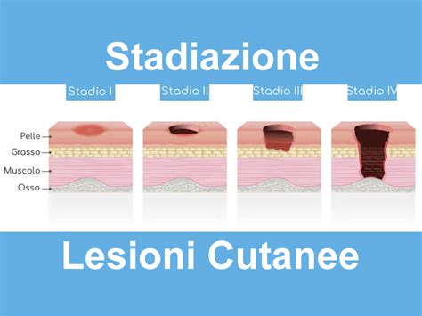 Illustrazione stilizzata che mostra diversi tipi di lesioni: un taglio, un livido e un gonfiore.